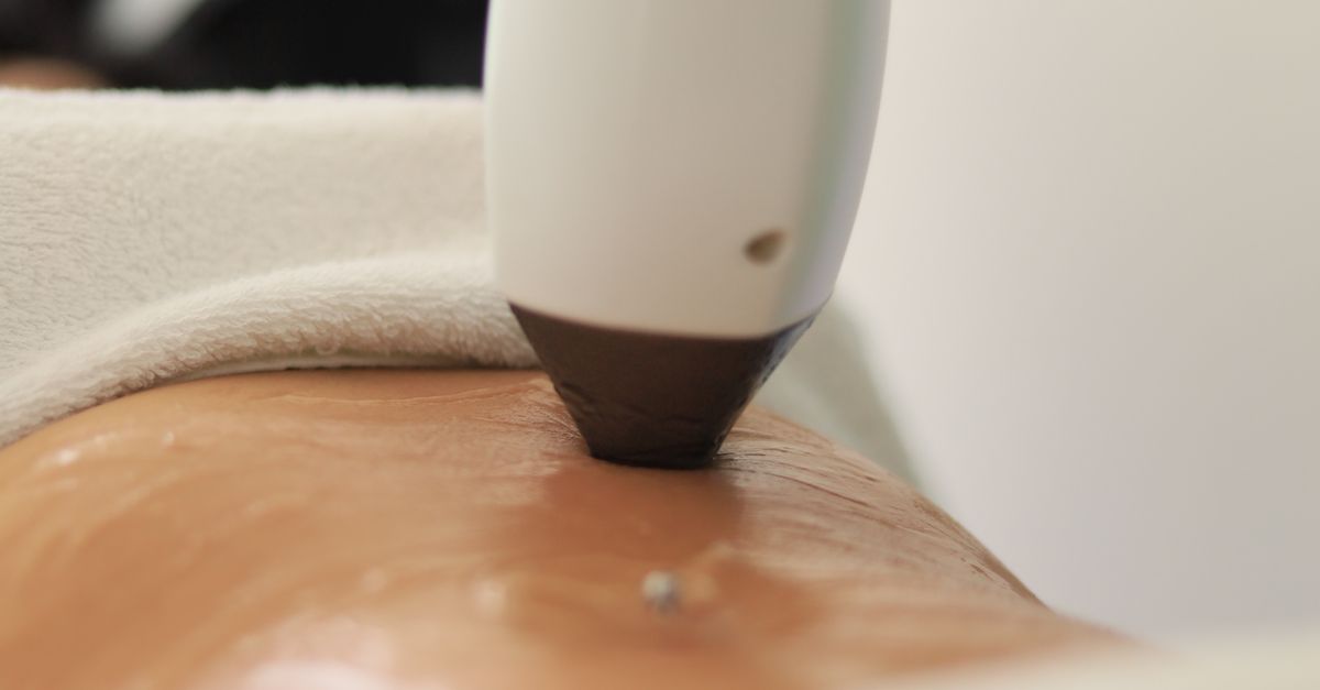 How to Choose the Right Moisturiser for Acne-Prone Skin