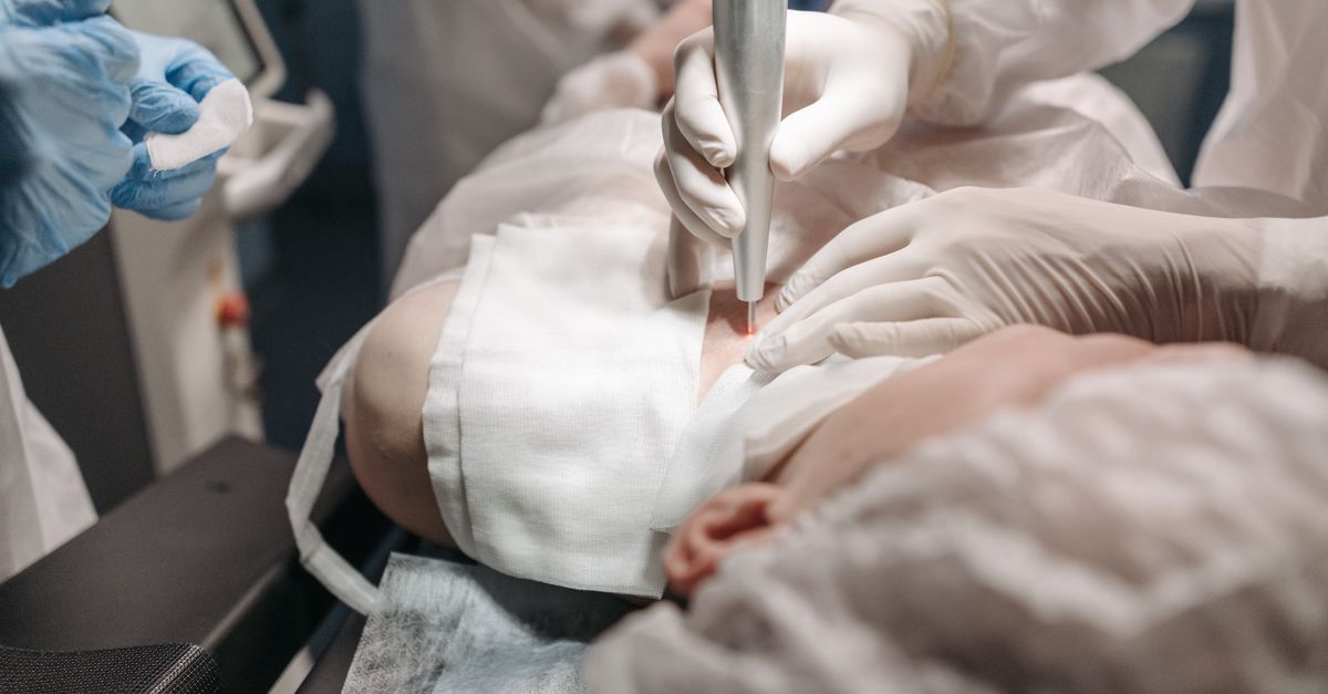 The Benefits of Chemical Peels for Skin Renewal in Surfers Paradise